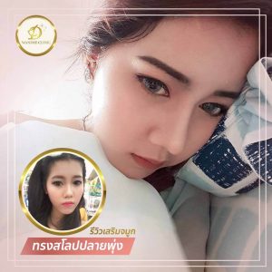 เสริมจมูก ขอนแก่น