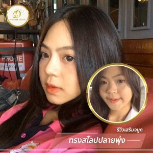 ทำจมูก ขอนแก่น