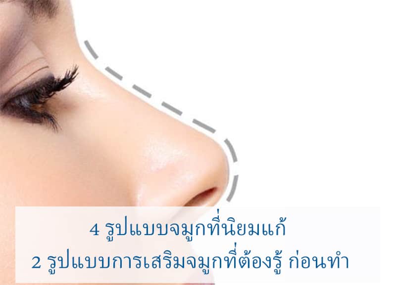 เสริมจมูกที่ไหนดี