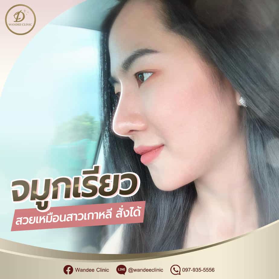 เสริมจมูก