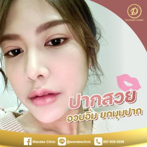 ปากกระจับขอนแก่น