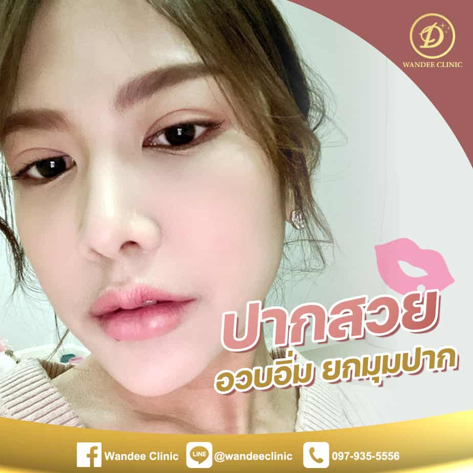 ปากกระจับขอนแก่น