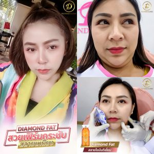 แฟตขอนแก่น