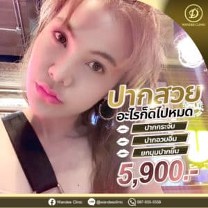 รีวิว ฟิลเลอร์ปาก
