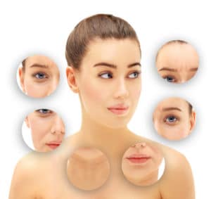 เสริมร่องแก้มขอนแก่น เตรียมตัวอย่างไร