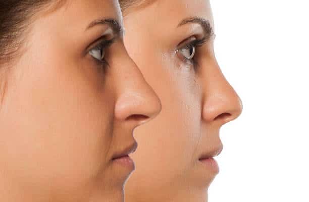 ฉีดปากอวบอิ่ม สายฝอ วันดีคลินิก