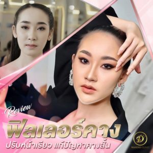 ฟิลเลอร์ขอนแก่น