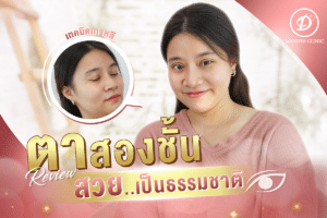 รีวิวทำตาสองชั้น