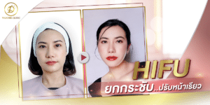 ทำHifuที่ไหนดี