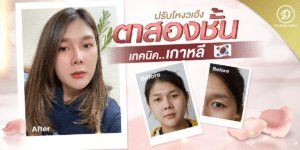 ทำตาสองชั้นแบบเกาหลี