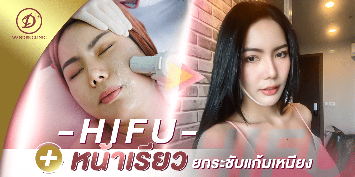 ทำHIFUที่ไหนดี