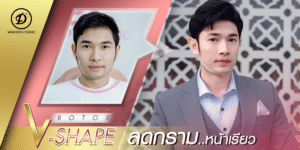 โบท็อกซ์ขอนแก่น