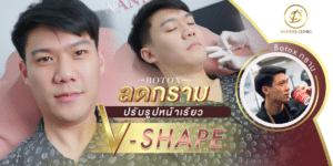 ฉีดโบท็อกซ์ขอนแก่น