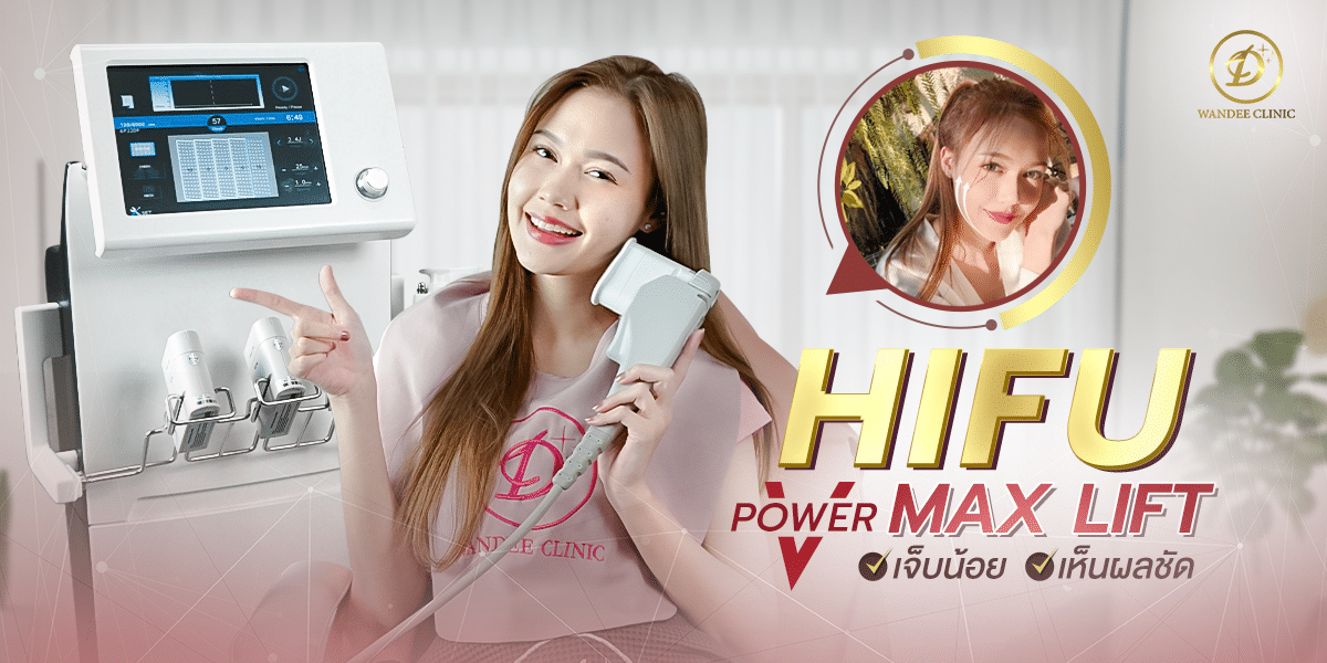 HIFUหน้ายกกระชับเป๊ะ รีวิว HIFU