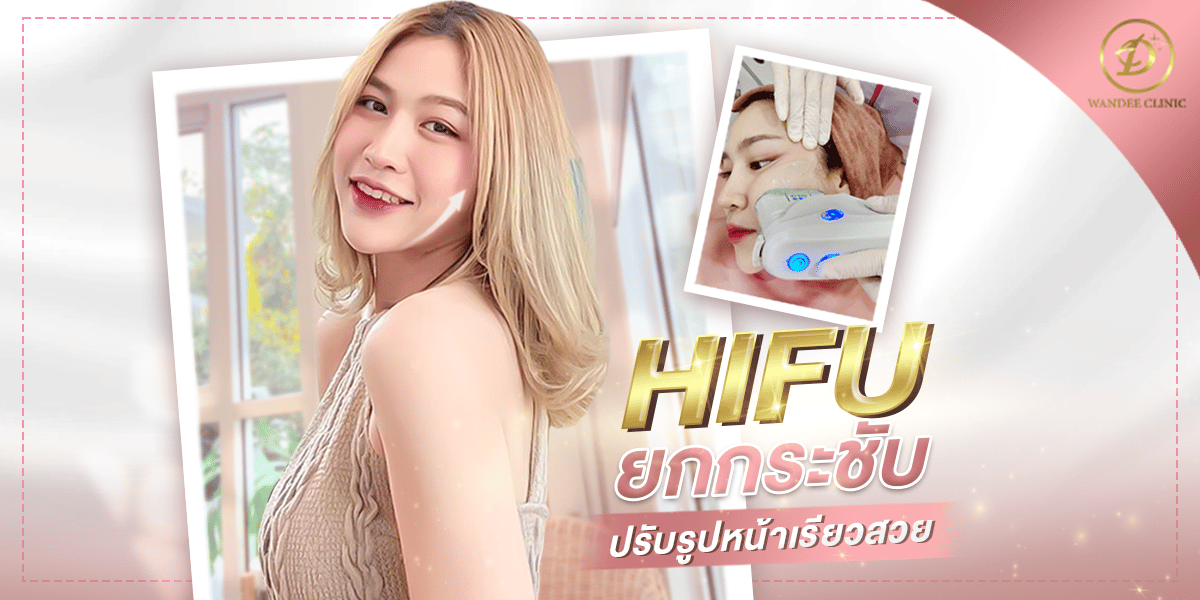 รีวิว HIFU