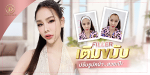 เติมขมับปรับรูปหน้าสวย