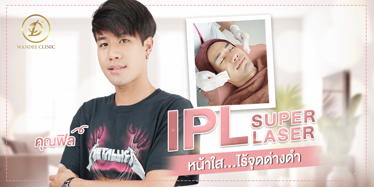 รีวิว IPL Laser