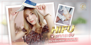 รีวิว HIFU