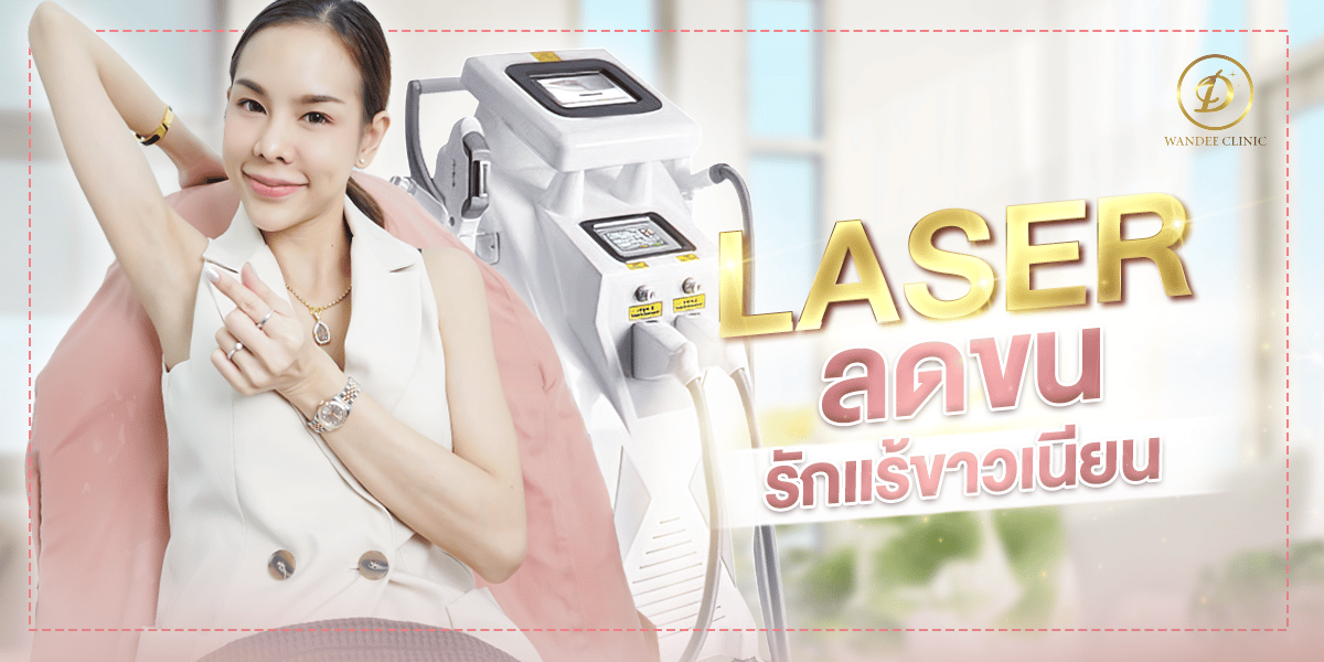 รีวิวเลเซอร์ขนรักแร้ IPL
