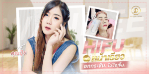 รีวิว HIFU