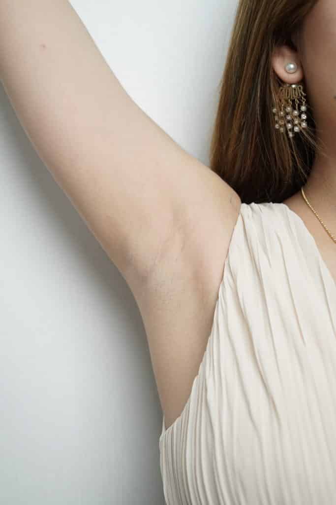 รีวิว Laser ขน