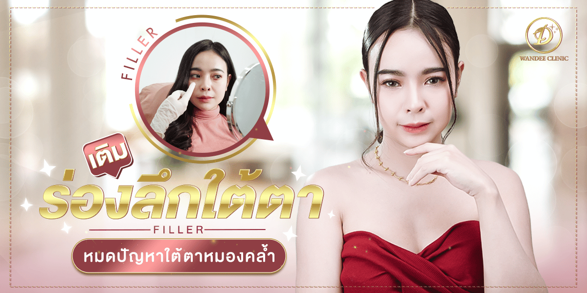 รีวิว Filler Restylane