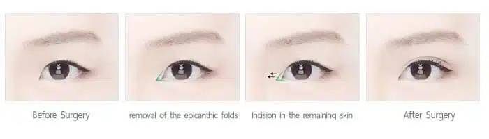 ตาสองชั้น