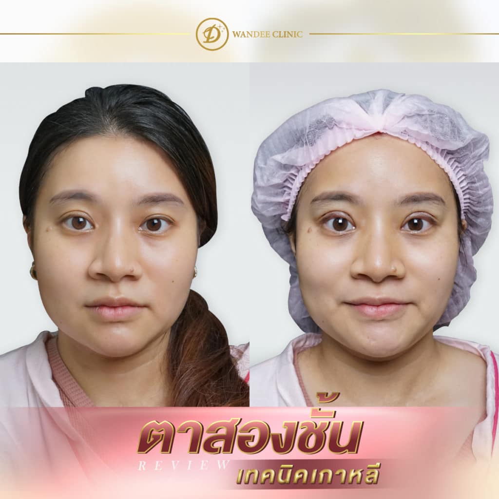 ทรงตาแบบไหนสวย