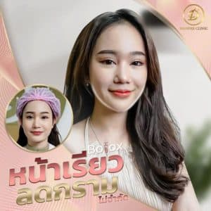 Botox Hugel ดีไหม