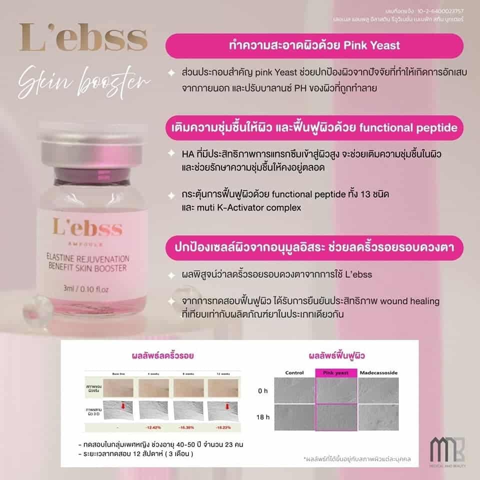 𝗟'𝗲𝗯𝘀𝘀