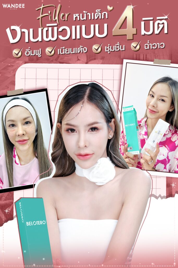 ฉีด Belotero Revive