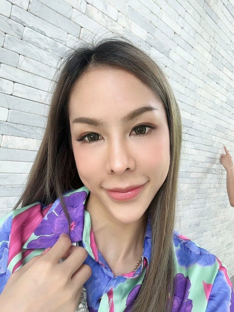 ฉีด Belotero Revive