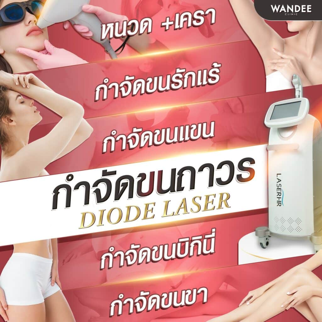 𝐃𝐢𝐨𝐝𝐞 𝐋𝐚𝐬𝐞𝐫 เลเซอร์กำจัดขน