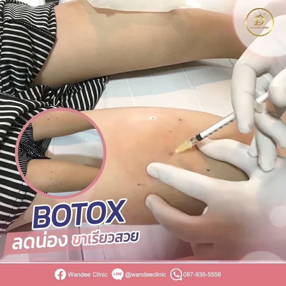 āļāļĩāļ botox āļāļĩāđāđāļŦāļāļāļĩ