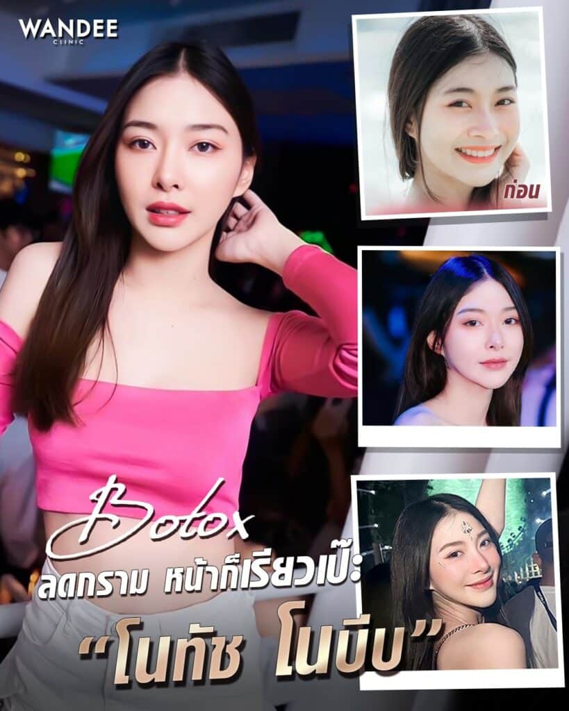 āļāļĩāļ botox āļāļĩāđāđāļŦāļāļāļĩ