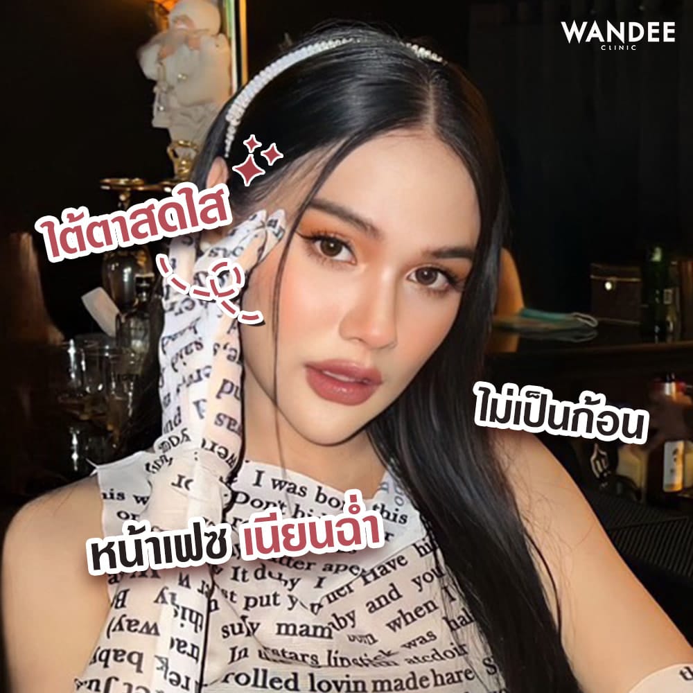 รีวิว Filler