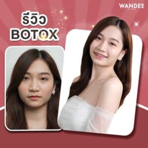 𝐁𝐨𝐭𝐨𝐱 ลดกราม