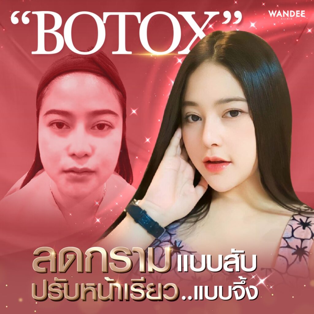 𝐁𝐨𝐭𝐨𝐱 ลดกราม หน้าเล็ก