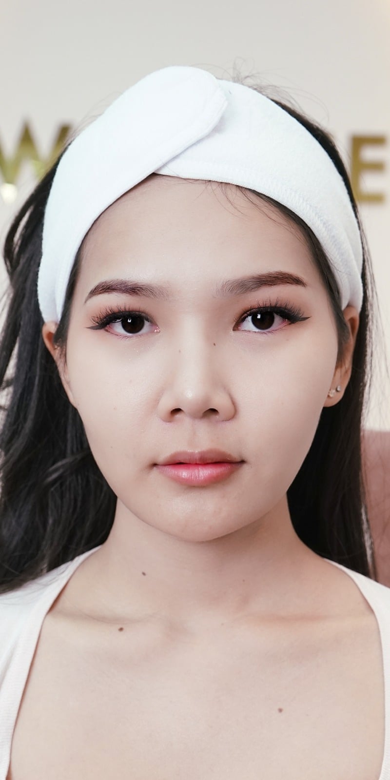 เติม 𝐅𝐢𝐥𝐥𝐞𝐫 ปาก