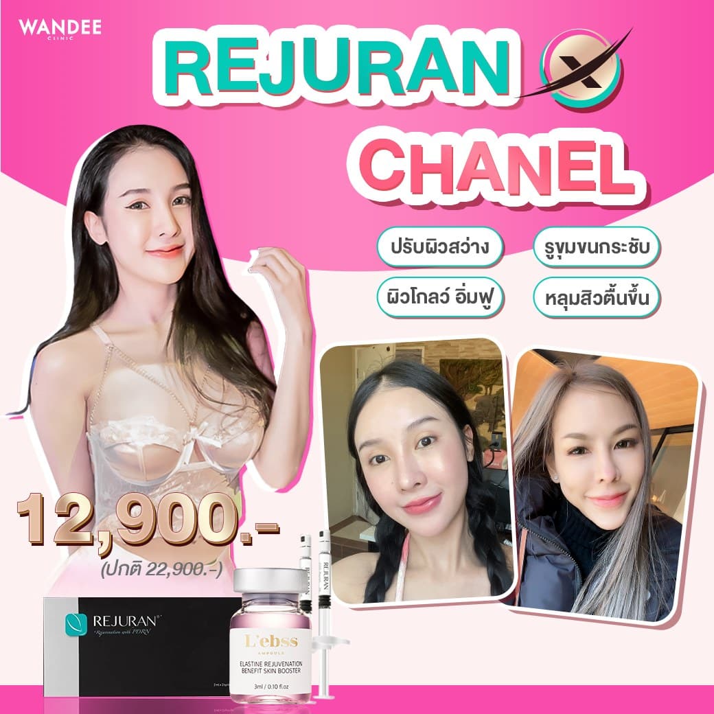 𝐑𝐄𝐉𝐔𝐑𝐀𝐍 𝐗 𝐂𝐇𝐀𝐍𝐄𝐋