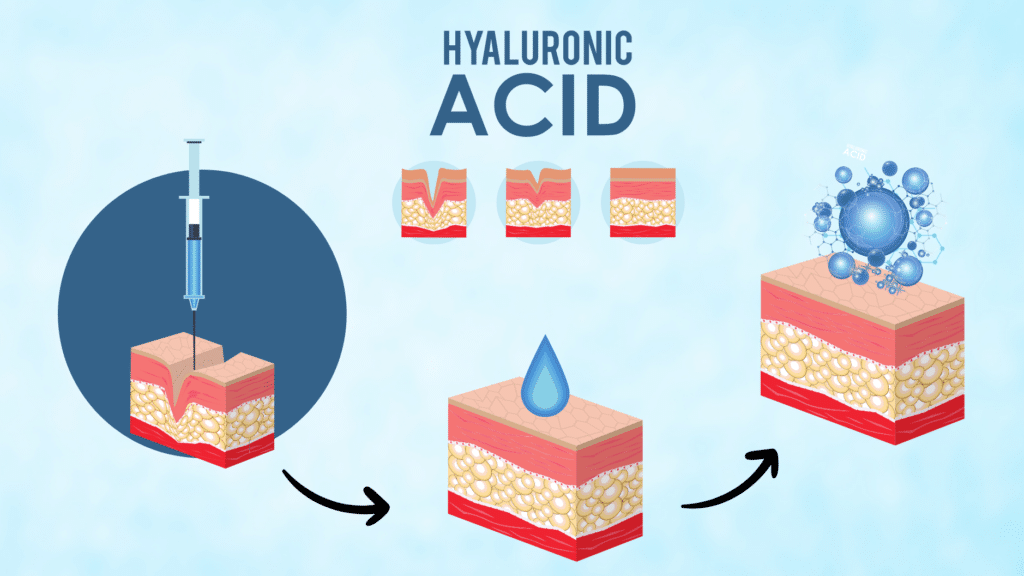 Hyaluronic Acid หรือ HA