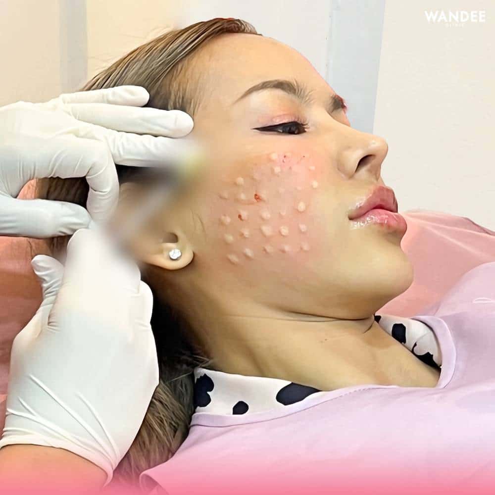 𝗘𝗫𝗢𝗦𝗢𝗠𝗘 สกินบูสเตอร์ตัวใหม่มาแรง