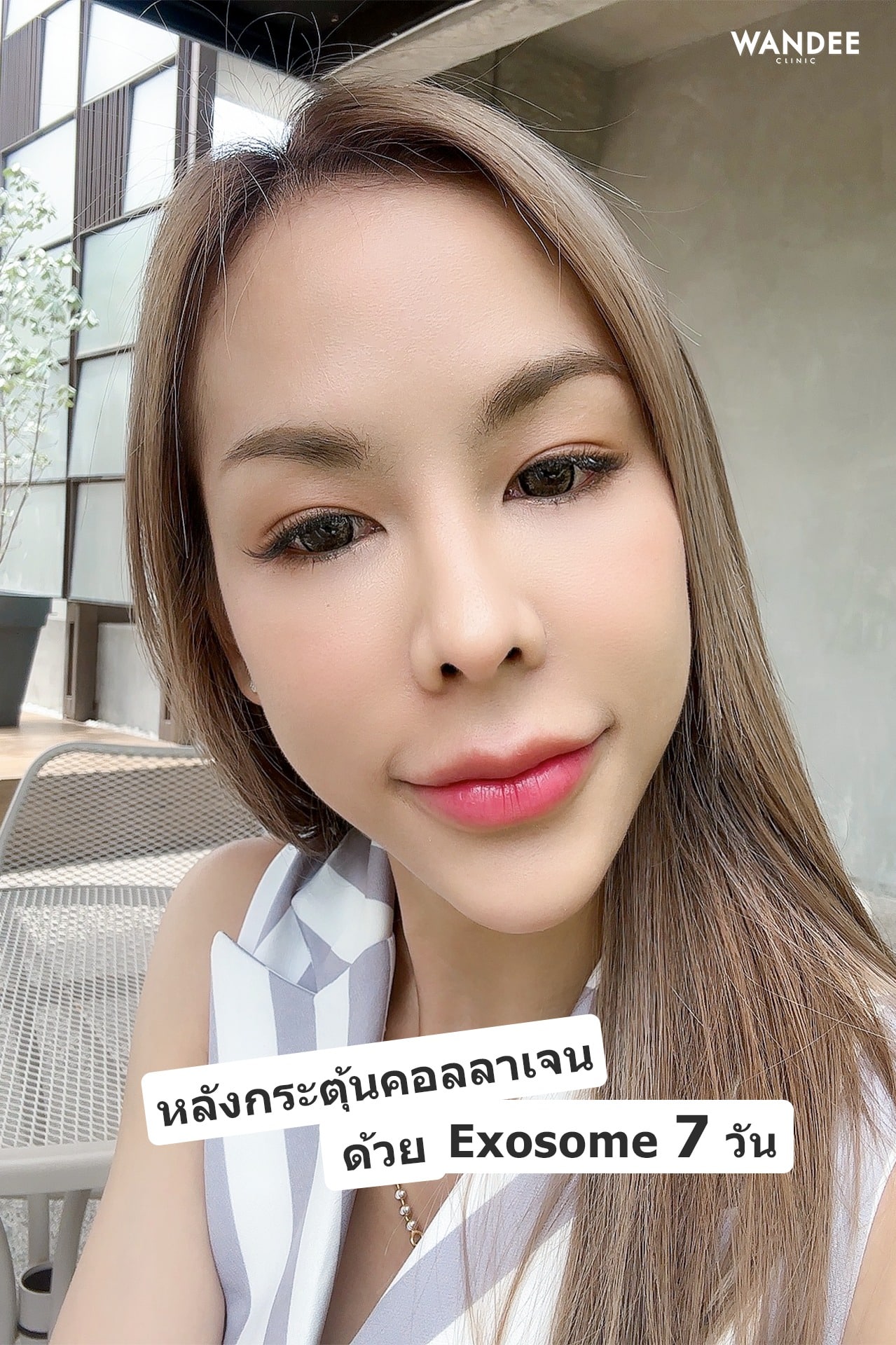 ASCE PLUS EXOSOME ดีอย่างไร?