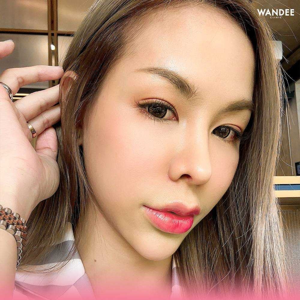 𝗘𝗫𝗢𝗦𝗢𝗠𝗘 สกินบูสเตอร์ตัวใหม่มาแรง