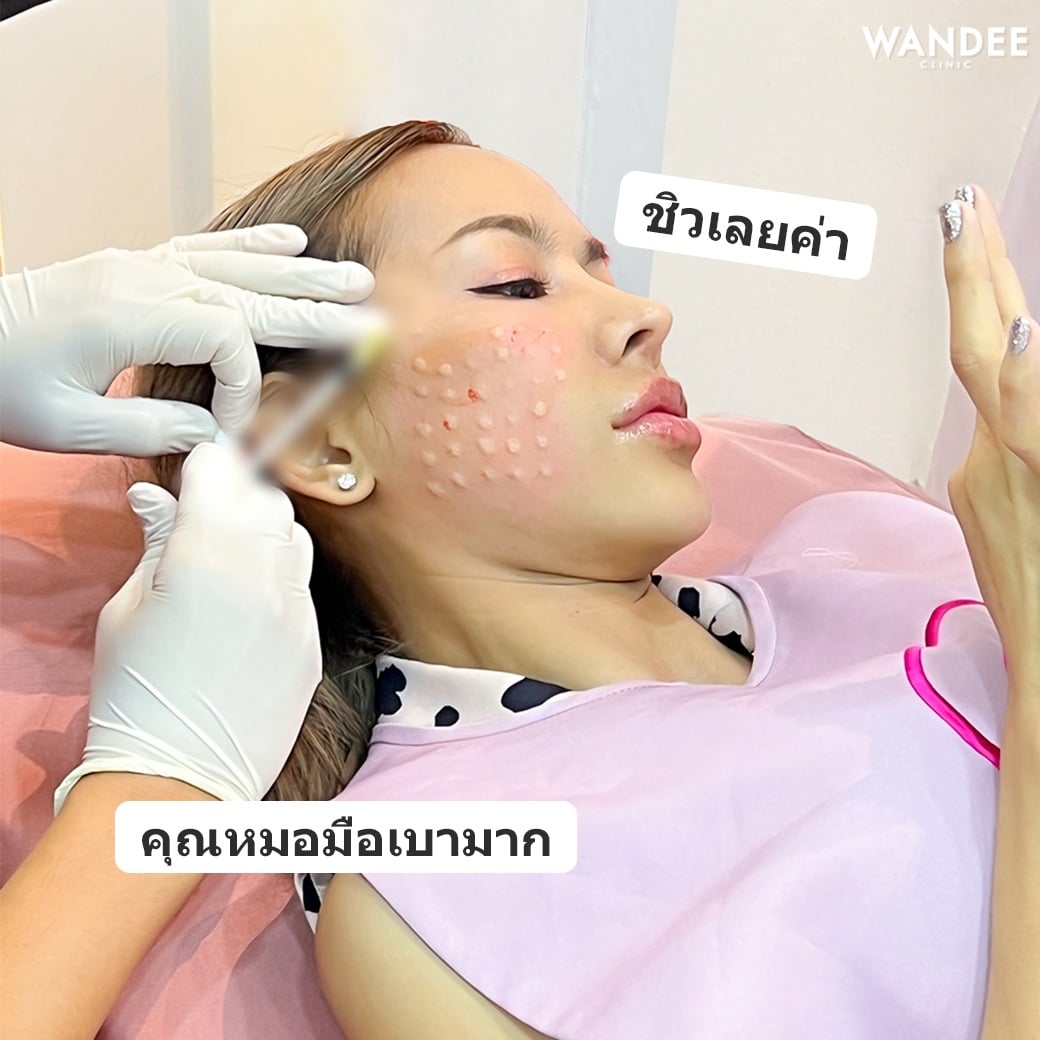 ASCE PLUS EXOSOME ดีอย่างไร?