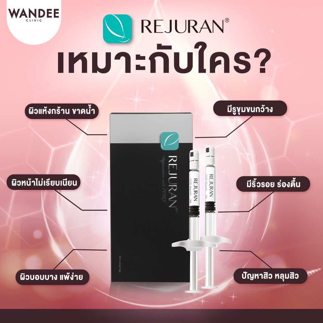 𝐄𝐗𝐎𝐒𝐎𝐌𝐄 𝐯𝐬 𝐑𝐄𝐉𝐔𝐑𝐀𝐍