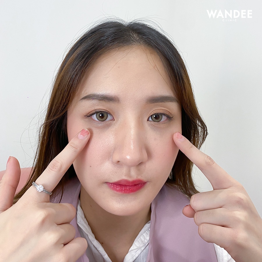 𝗙𝗜𝗟𝗟𝗘𝗥 ใต้ตา