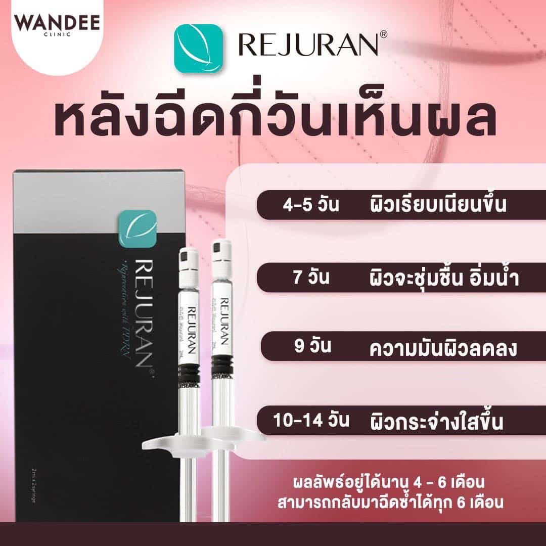 𝐄𝐗𝐎𝐒𝐎𝐌𝐄 𝐯𝐬 𝐑𝐄𝐉𝐔𝐑𝐀𝐍