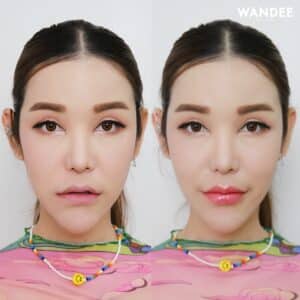 เติม 𝗙𝗜𝗟𝗟𝗘𝗥 ปากครั้งแรก