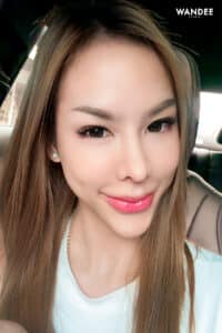 𝐁𝐎𝐓𝐎𝐗 ลดริ้วรอย